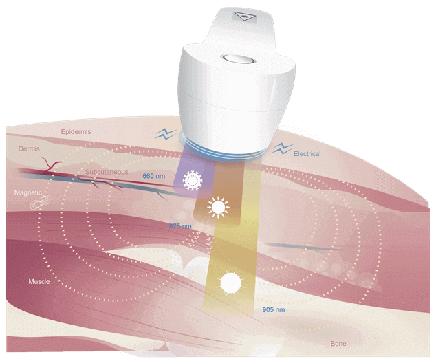 Dynamic Air Compression