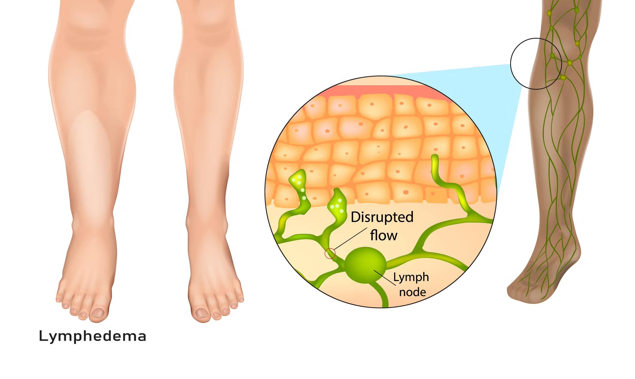 Dynamic Air Compression